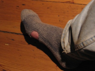 The burned sock My burned sock.
